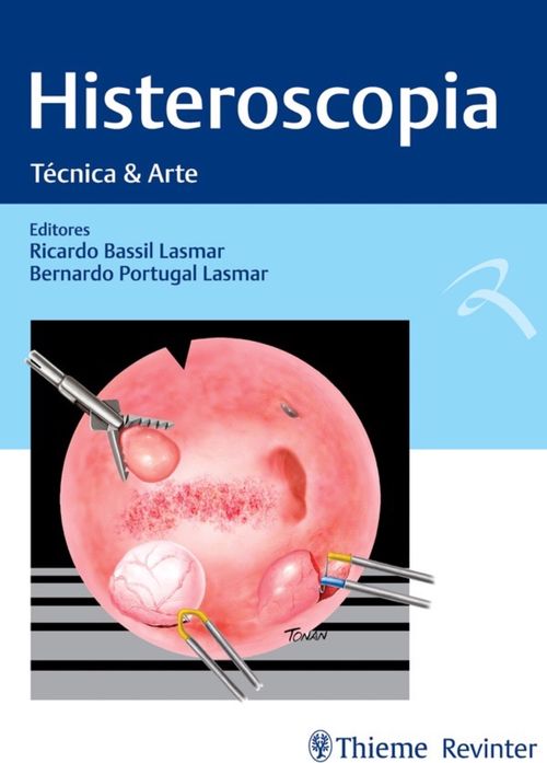 Histeroscopia