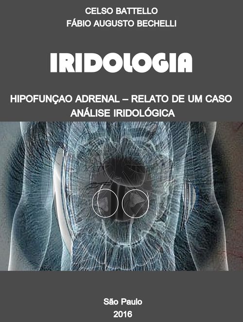 Iridologia - Hipofunção Adrenal