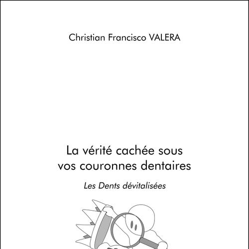 La vérité cachée sous vos couronnes dentaires