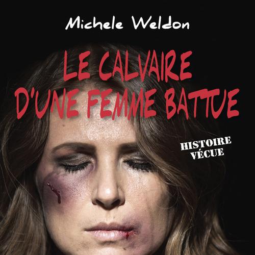 Le calvaire d’une femme battue