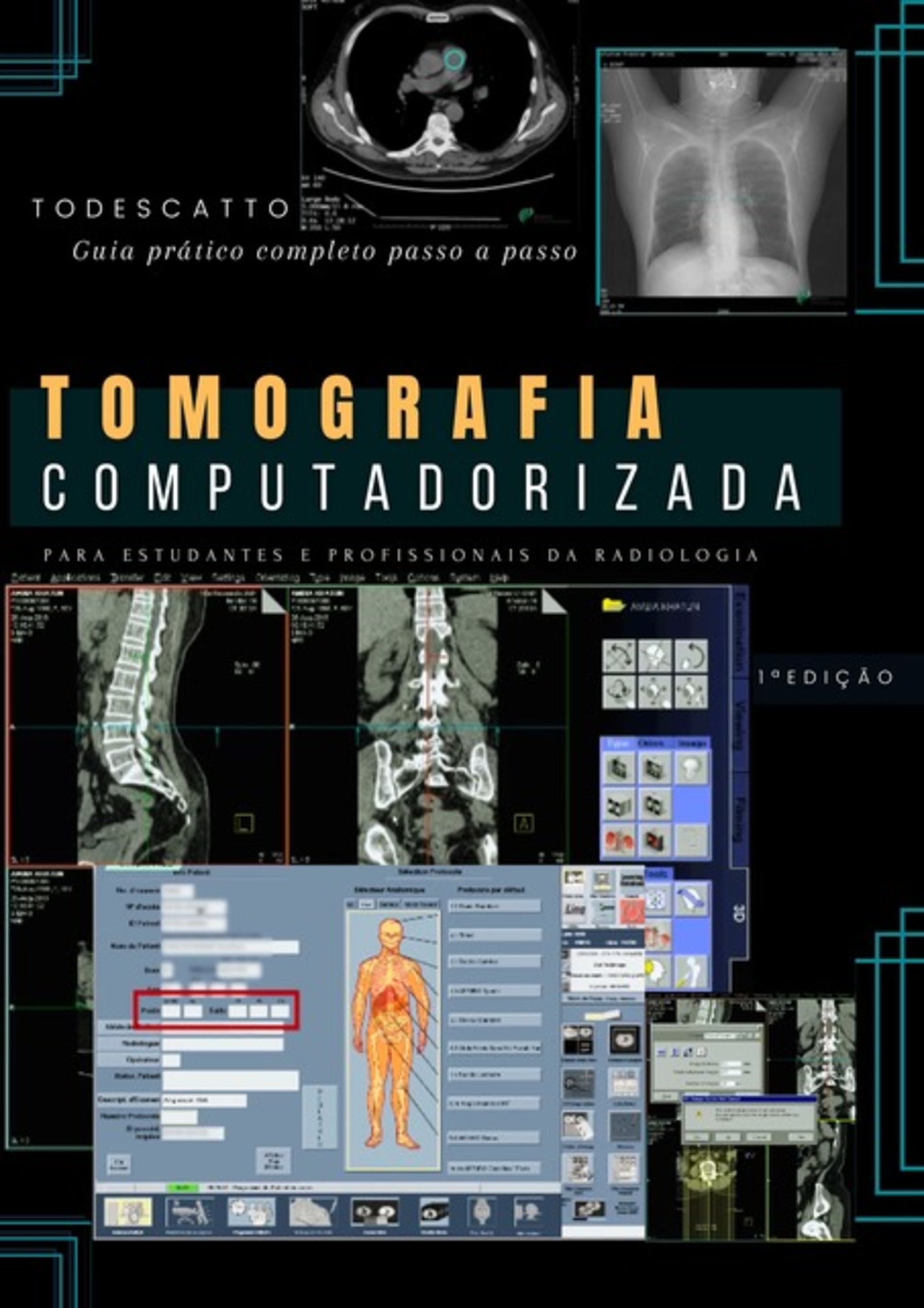 Livro De Tomografia Computadorizada