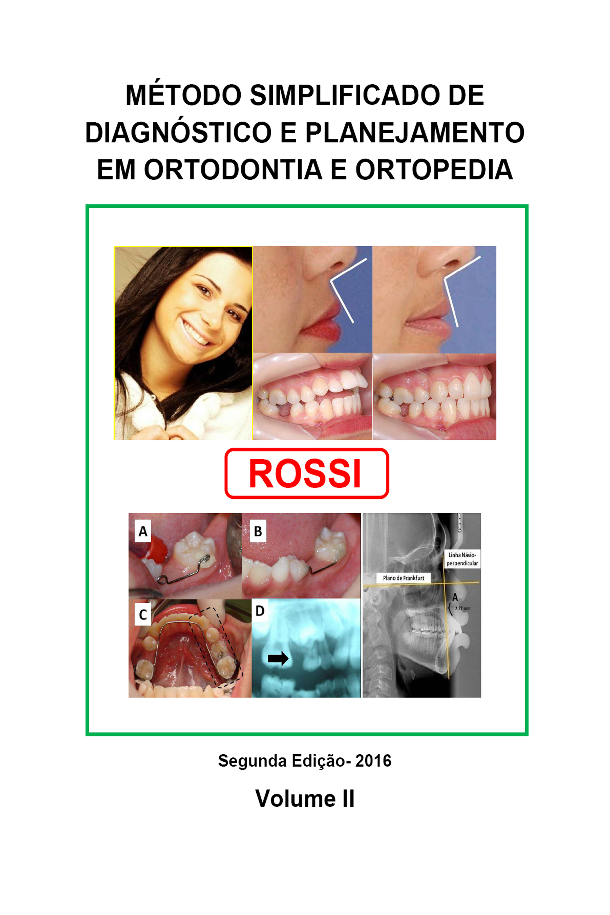 MÉTODO SIMPLIFICADO DE DIAGNÓSTICO E PLANEJAMENTO EM ORTODONTIA E ORTOPEDIA