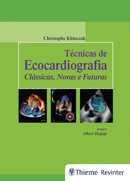 Técnicas de Ecocardiografia