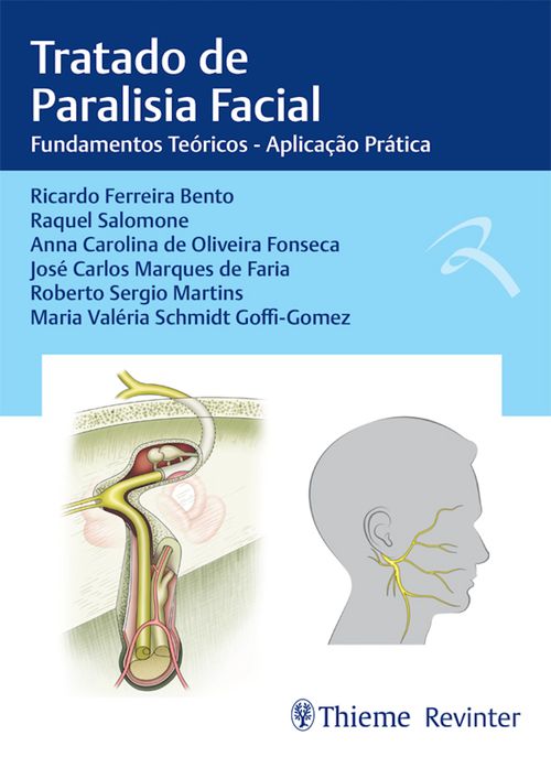 Tratado de paralisia facial