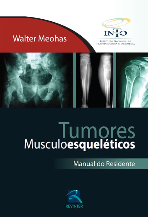 Tumores Musculoesqueléticos