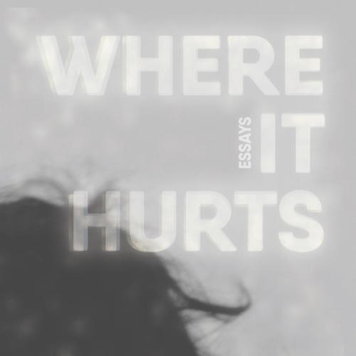 Where It Hurts